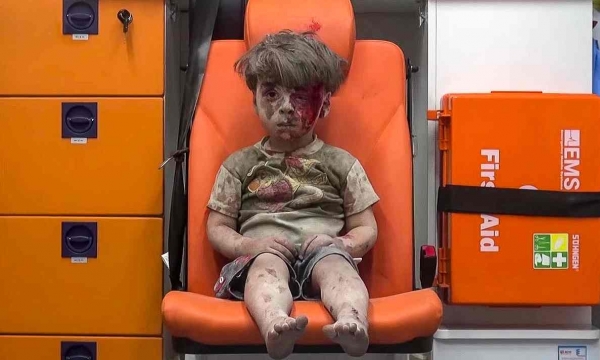 Nhiếp ảnh gia kể lại khoảnh khắc đau đớn khi chụp bức ảnh cậu bé Syria bị thương
